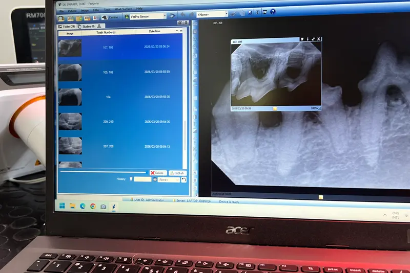 Dental Xray
